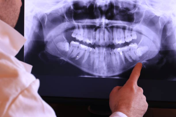 Best Holiday Emergency Dentist in Burgettstown, PA